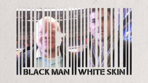 Black Man White Skin