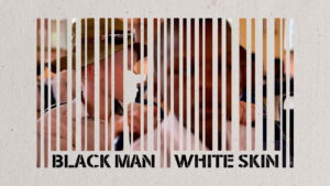 Black Man White Skin
