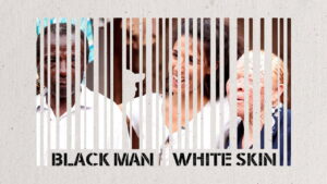 Black Man White Skin