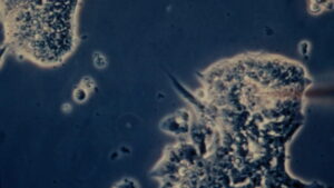 Our Genes Under Influence