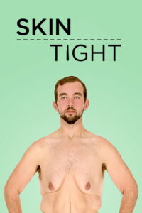 My Extreme Excess Skin